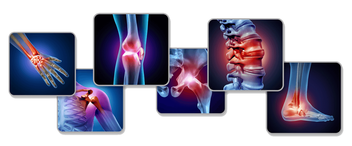 Collection of x-rays showing painful joints in spine, shoulder, knee, hip foot and hand